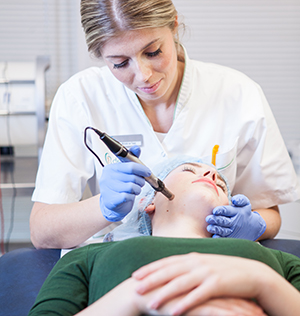 microneedling dermapen huidverbetering