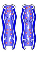 spatader aderklepje kapotte varices