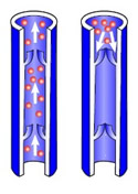 spatader aderklepje normale varicose