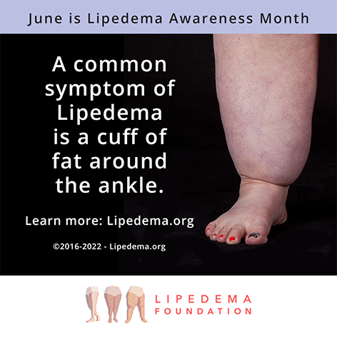 lipedema awareness month 2022