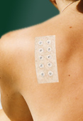 plakproef contactallergie